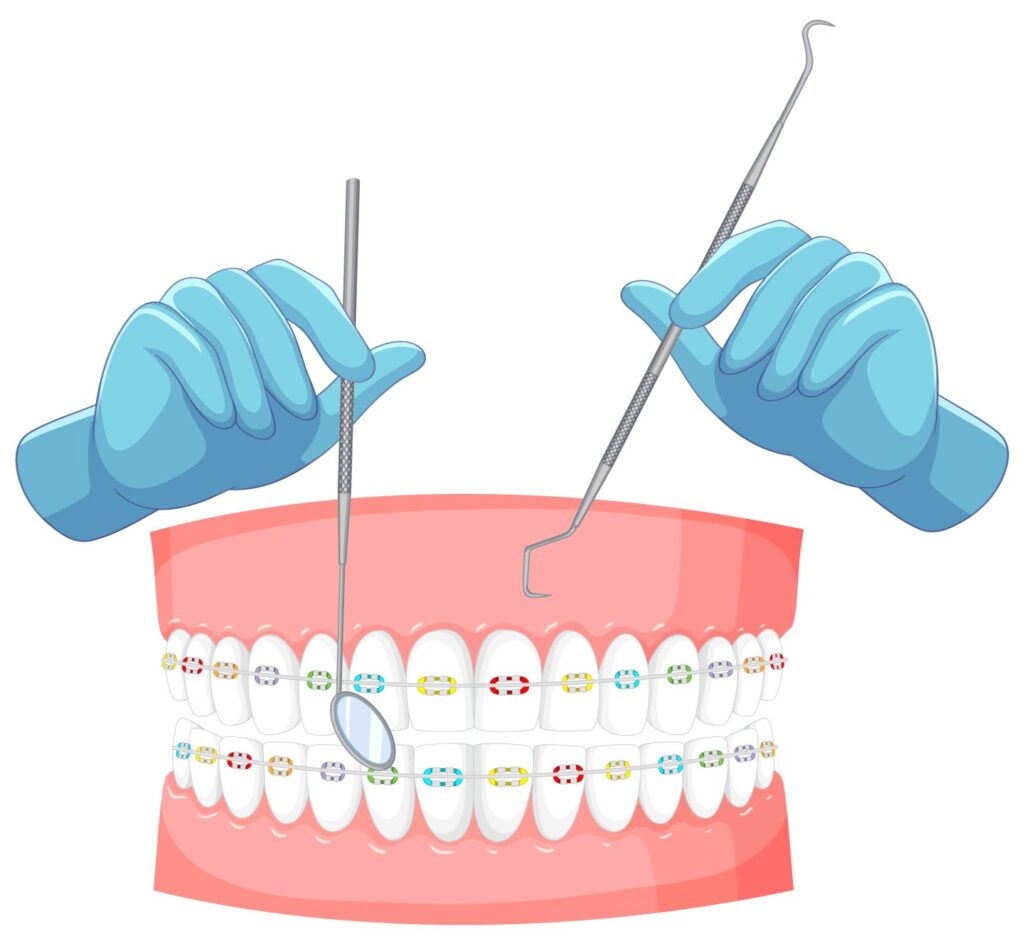 adjustment of palate expander, palatal expander, palate expander