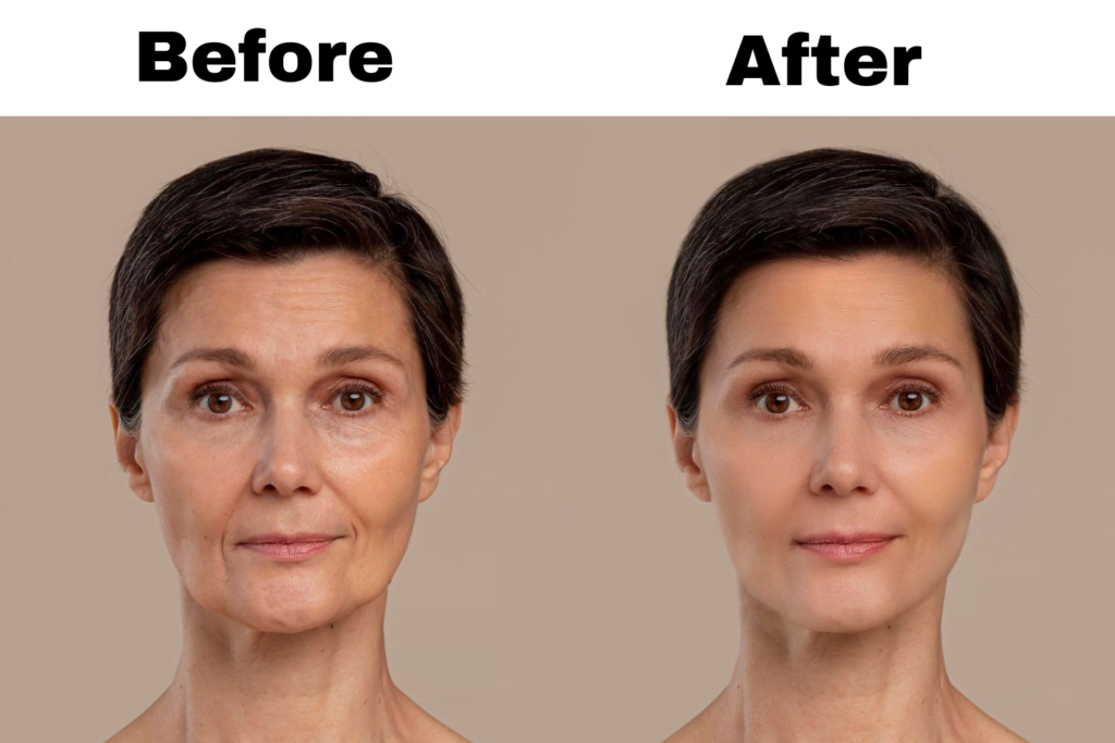 Turf Burn Treatment Promoting Healing and Relieving