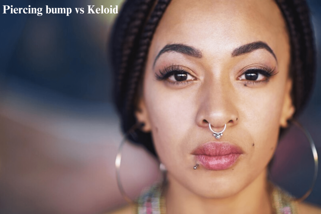 Piercing bump vs Keloid