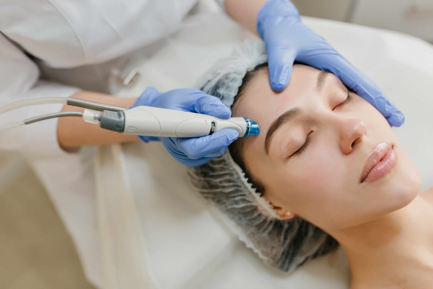 What is Microneedling? Microneedling